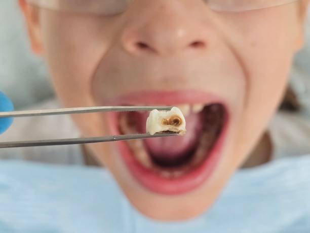 Best Weekend Emergency Dentist in Burgettstown, PA